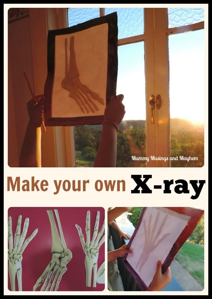 xray-2Bpin-2Bcollage.jpg xray-2Bpin-2Bcollage.jpg